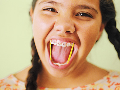 kidswithbraces1